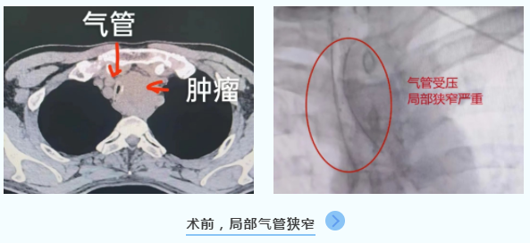 捕獲.PNG